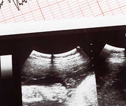 fetal heart Echocardiography